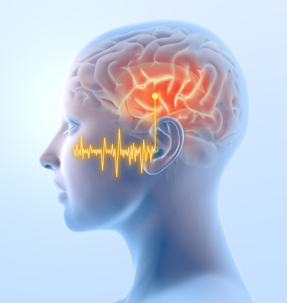 Tinnitus and the brain